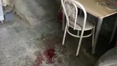 Sandalyeden Düşerek Yaralanan Adamın Hayatı Kısa Sürede Değişti
