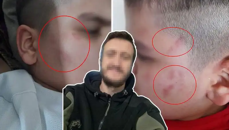 Otizmli Çocuğa Okulda Şiddet: Olayın Detayları ve Tepkiler