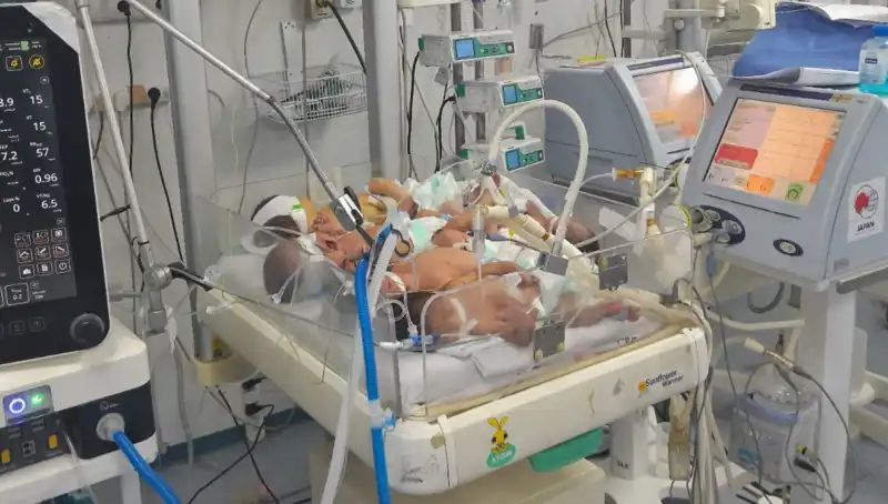 Gaza Sağlık Krizi: Doktorlar Birden Fazla Bebekle Mücadele Ediyor