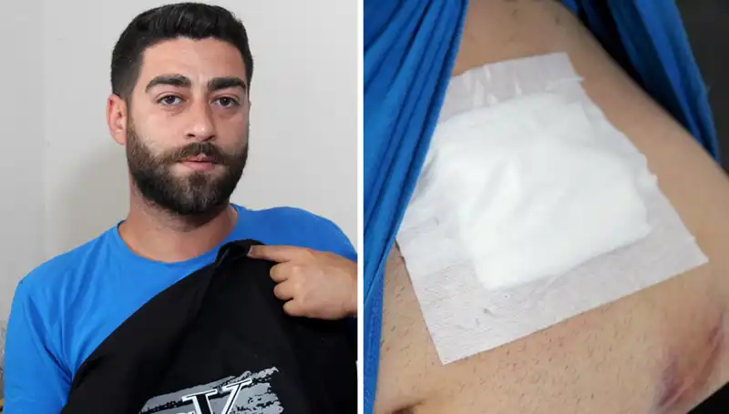 Karnında Hissettiği Ağrı, Yaşamını Değiştiren Teşhisi Ortaya Çıkardı