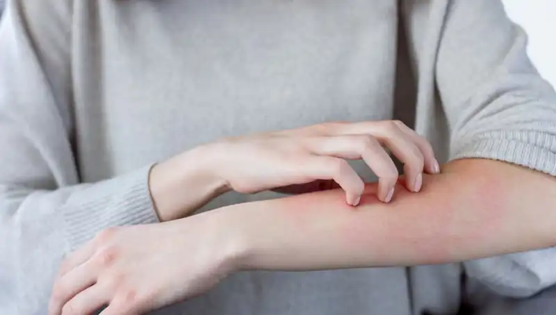 Cilt Kanserinin Gizli Belirtileri: Dermatologun Dikkat Çeken İpuçları