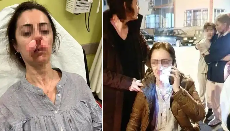 Eşinin Sevgilisi Sandığı Otomobil Kapısıyla Saldırdı: Silah Sayıldı!