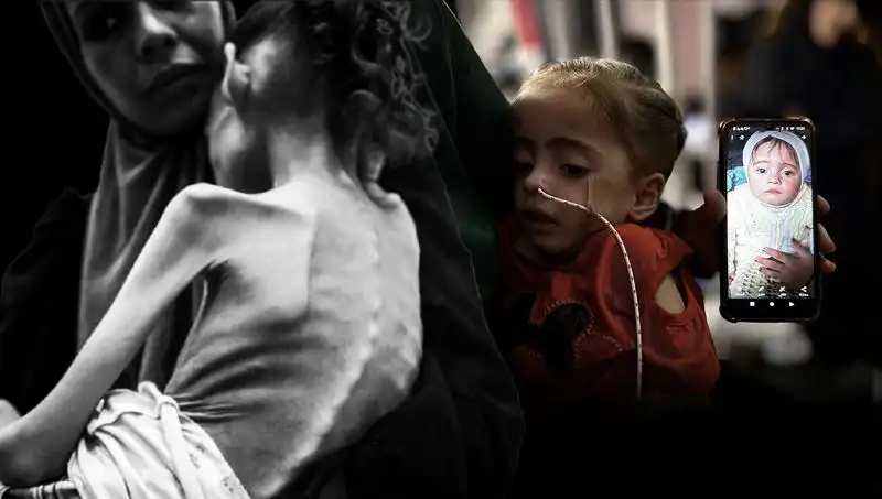 Küçük Meryem'in Açlık Mücadelesi: 25 Kilodan 10 Kiloya Düşen Hayat Hikayesi